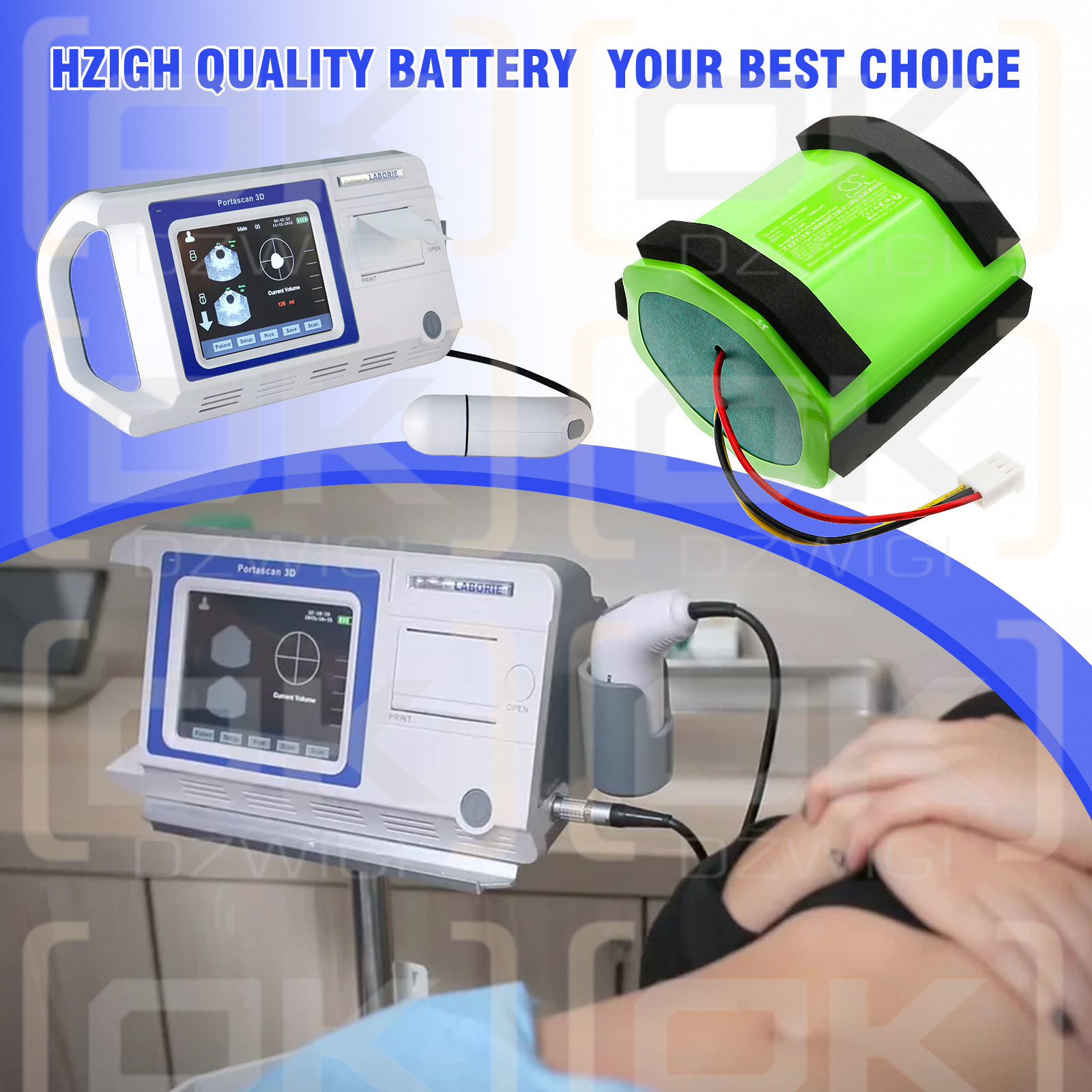 Mediwatch Portascan Ultrasound Bladder Scanner / 110844 3600mAh Ni-MH 12.0V (Cameron Sino)