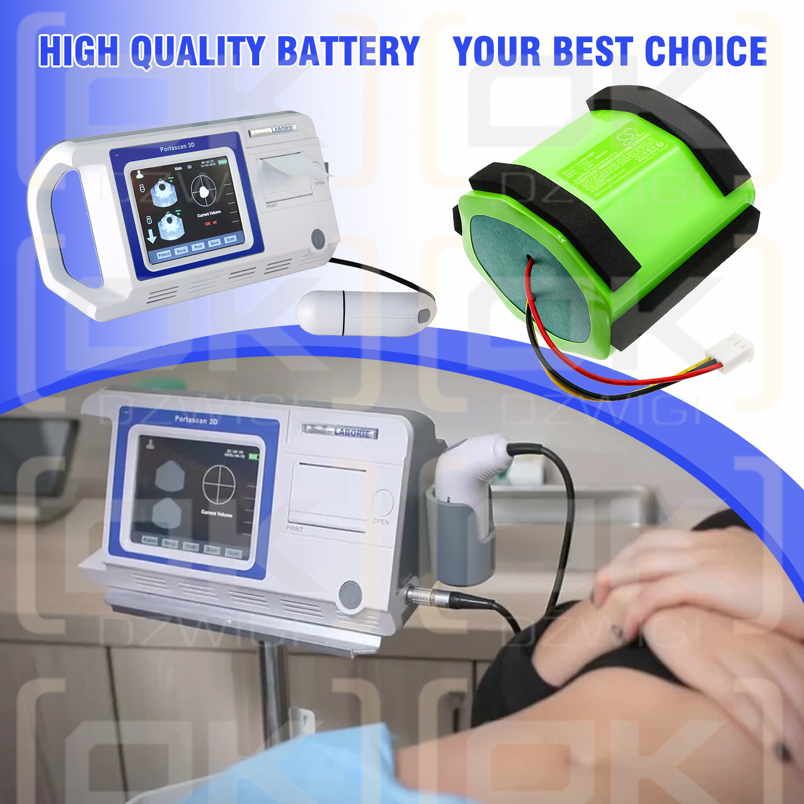 Mediwatch Portascan Ultraschall-Blasenscanner / 110844 3600 mAh Ni-MH 12,0 V (Cameron Sino)