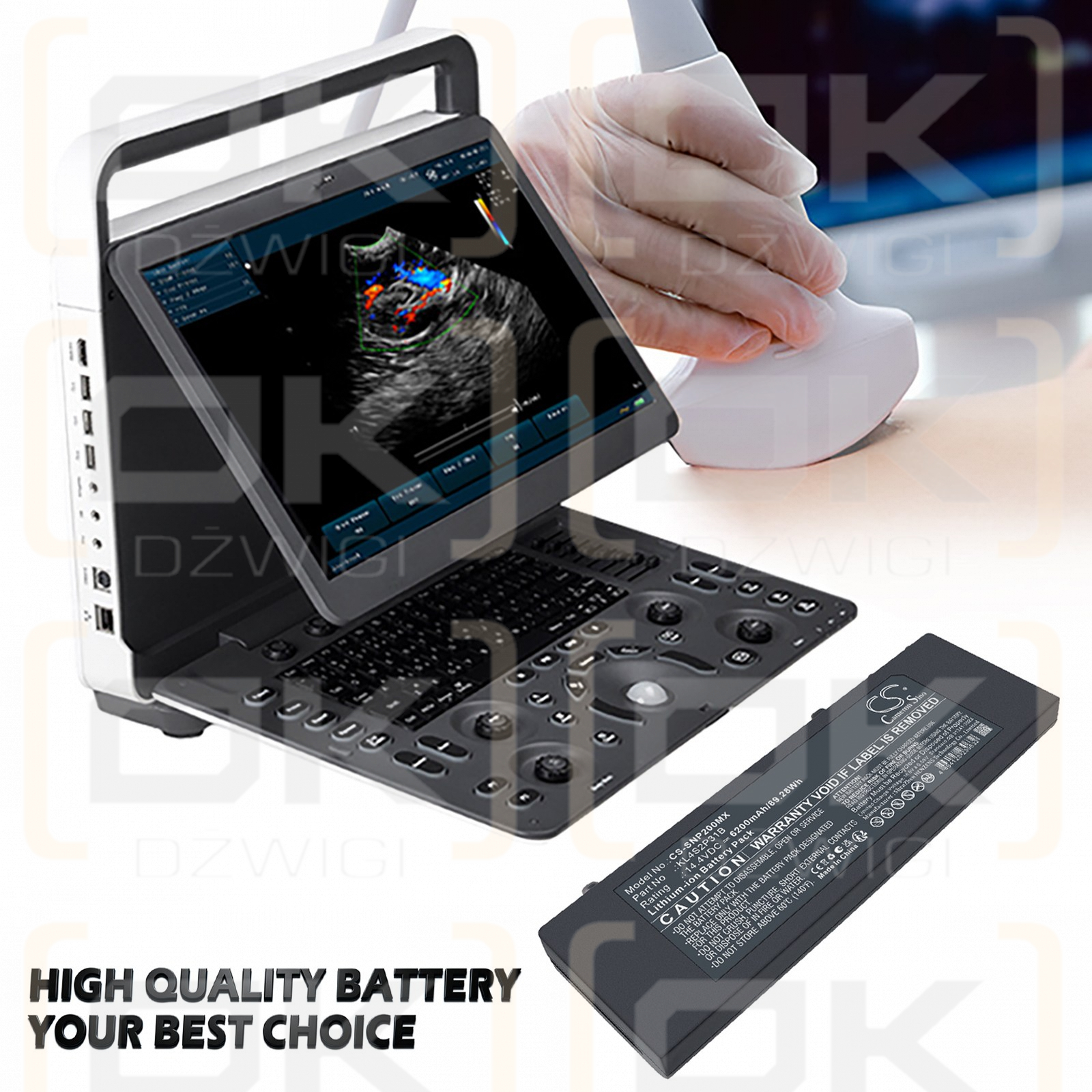 Сменный аккумулятор для SonoScape X5 / KL4S2P31A 12400 мАч Li-ion 14,4 В (Cameron Sino)